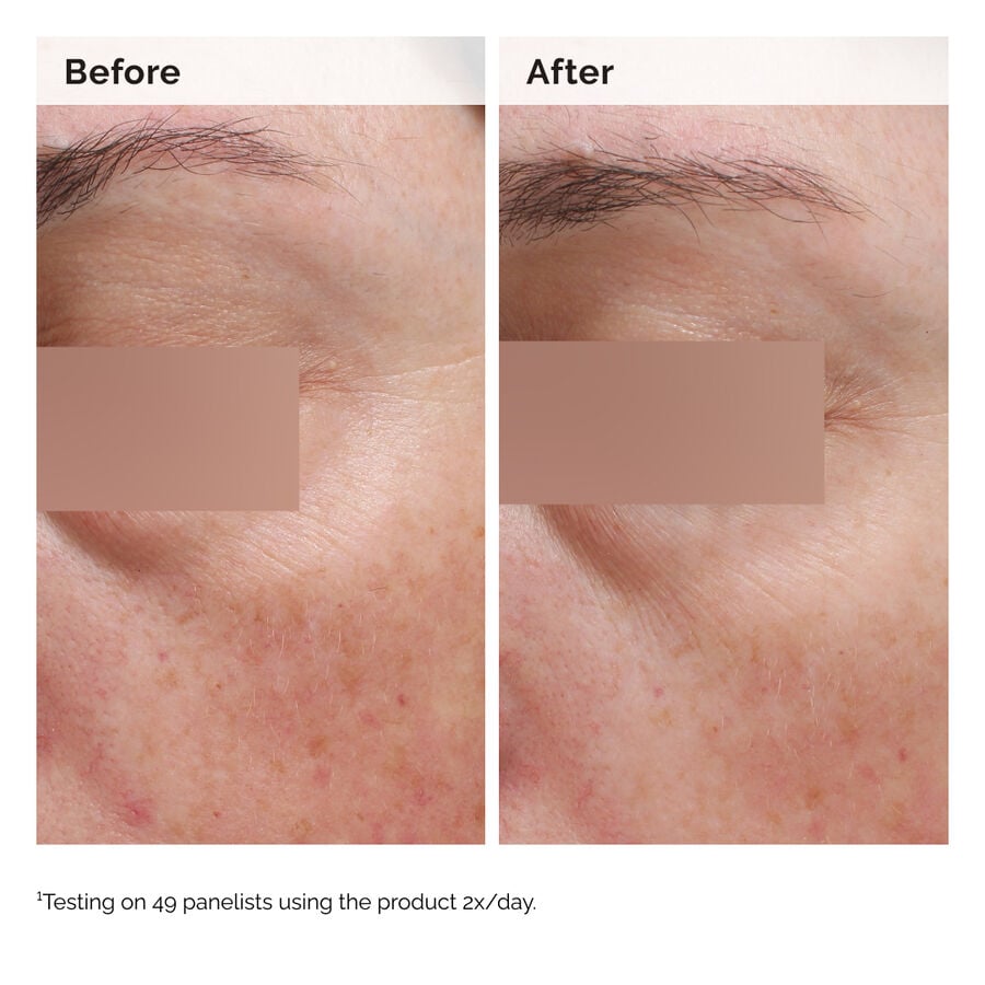 niacinamide-5-face-and-body-emulsion-z4 2024-08-23-ORD-Nia-5pct-Face-Body-B-A-Elasticity-Global-02-1x1.jpg