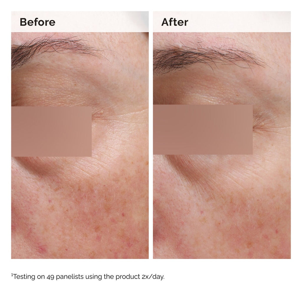 niacinamide-5-face-and-body-emulsion-z4 2024-08-23-ORD-Nia-5pct-Face-Body-B-A-Elasticity-Global-02-1x1.jpg