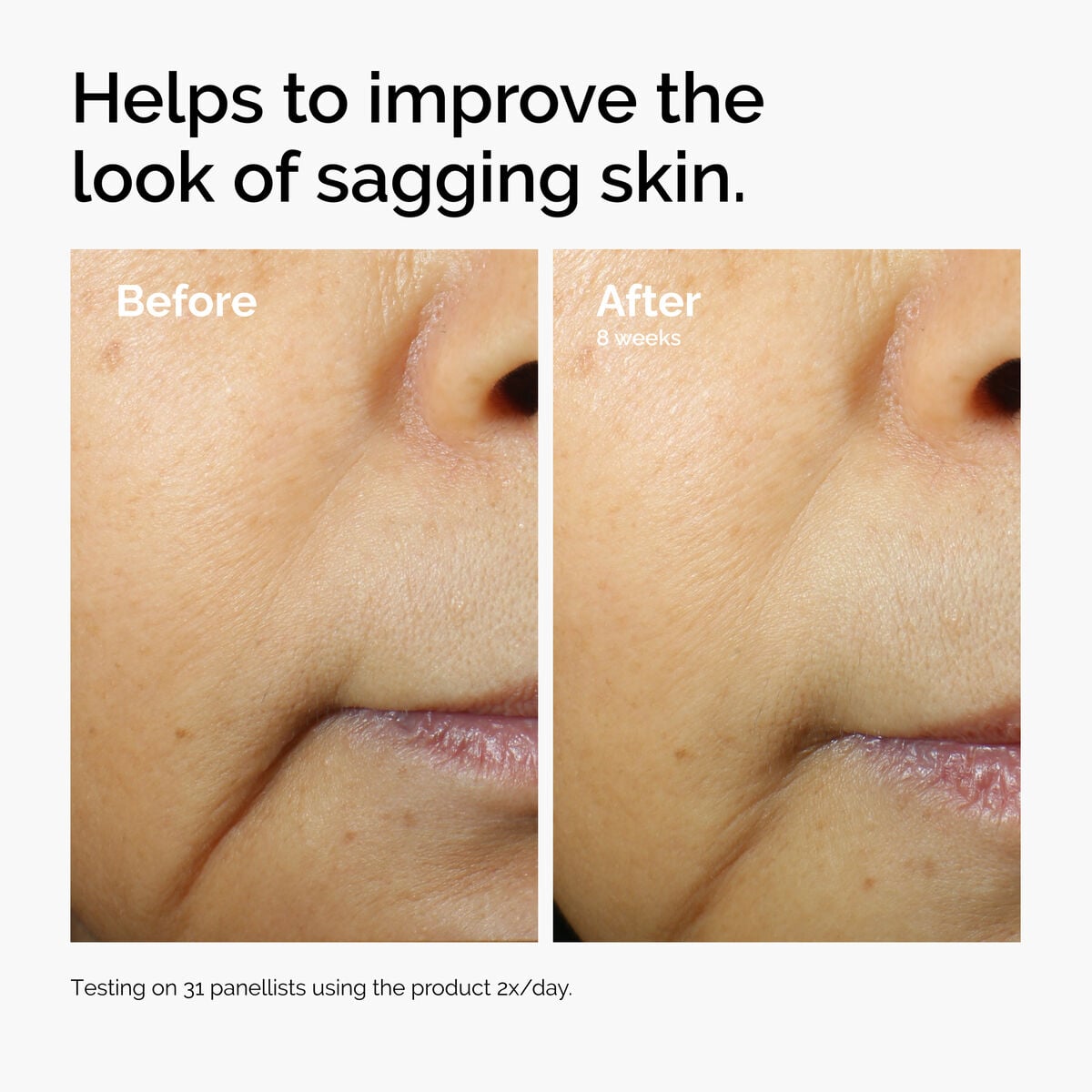 caffeine-3-escin-1-face-serum-x8 ord-caffeine-3pct-escin-1pct-face-serum-before-after-sagging.jpg