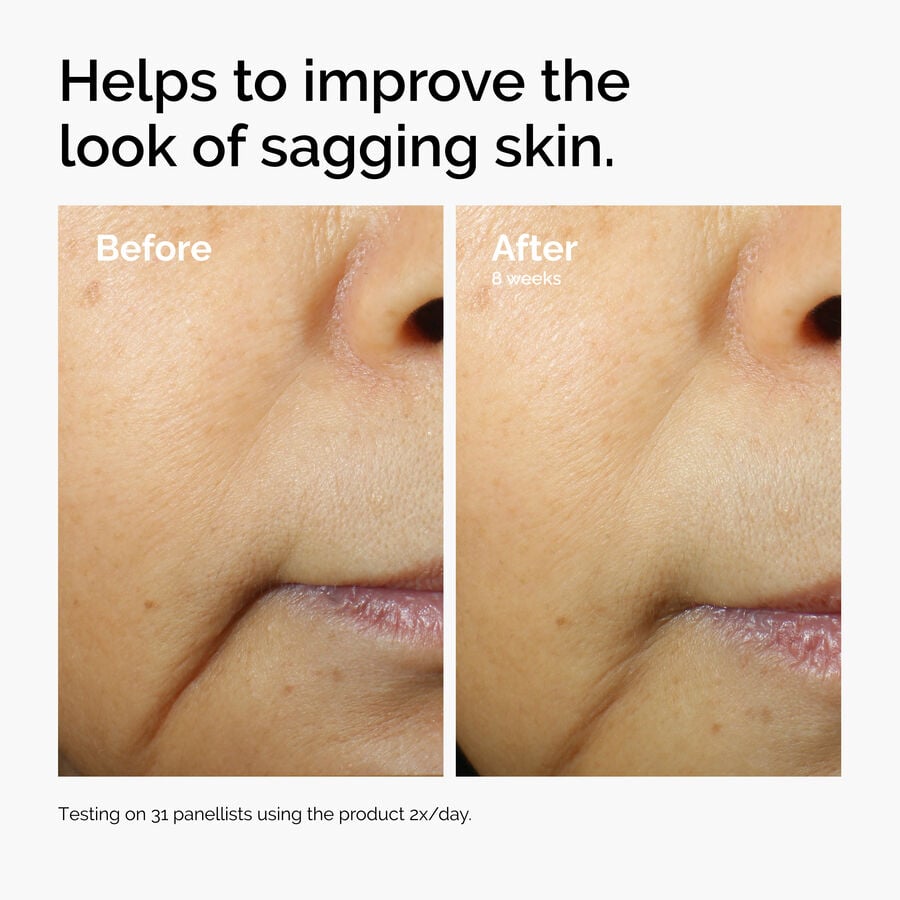 caffeine-3-escin-1-face-serum-x8 ord-caffeine-3pct-escin-1pct-face-serum-before-after-sagging.jpg