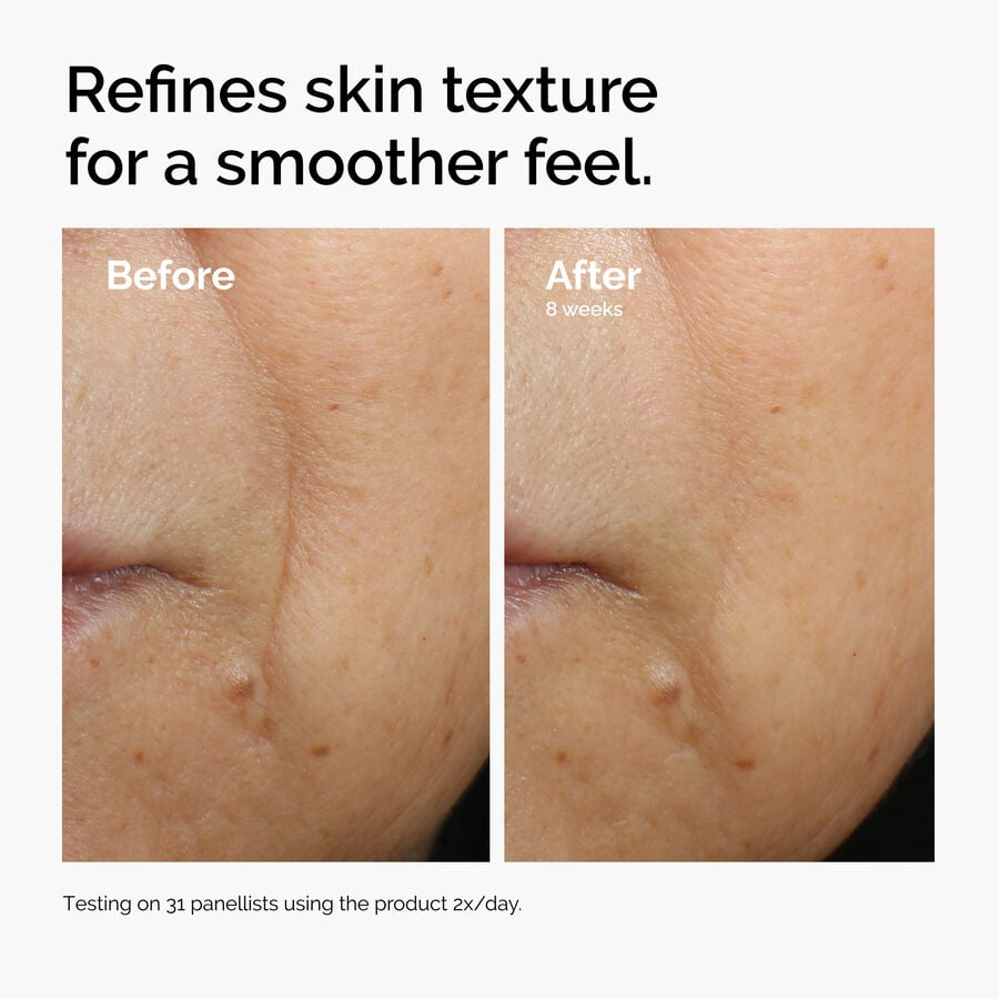 caffeine-3-escin-1-face-serum-x8 ord-caffeine-3pct-escin-1pct-face-serum-before-after-texture.jpg
