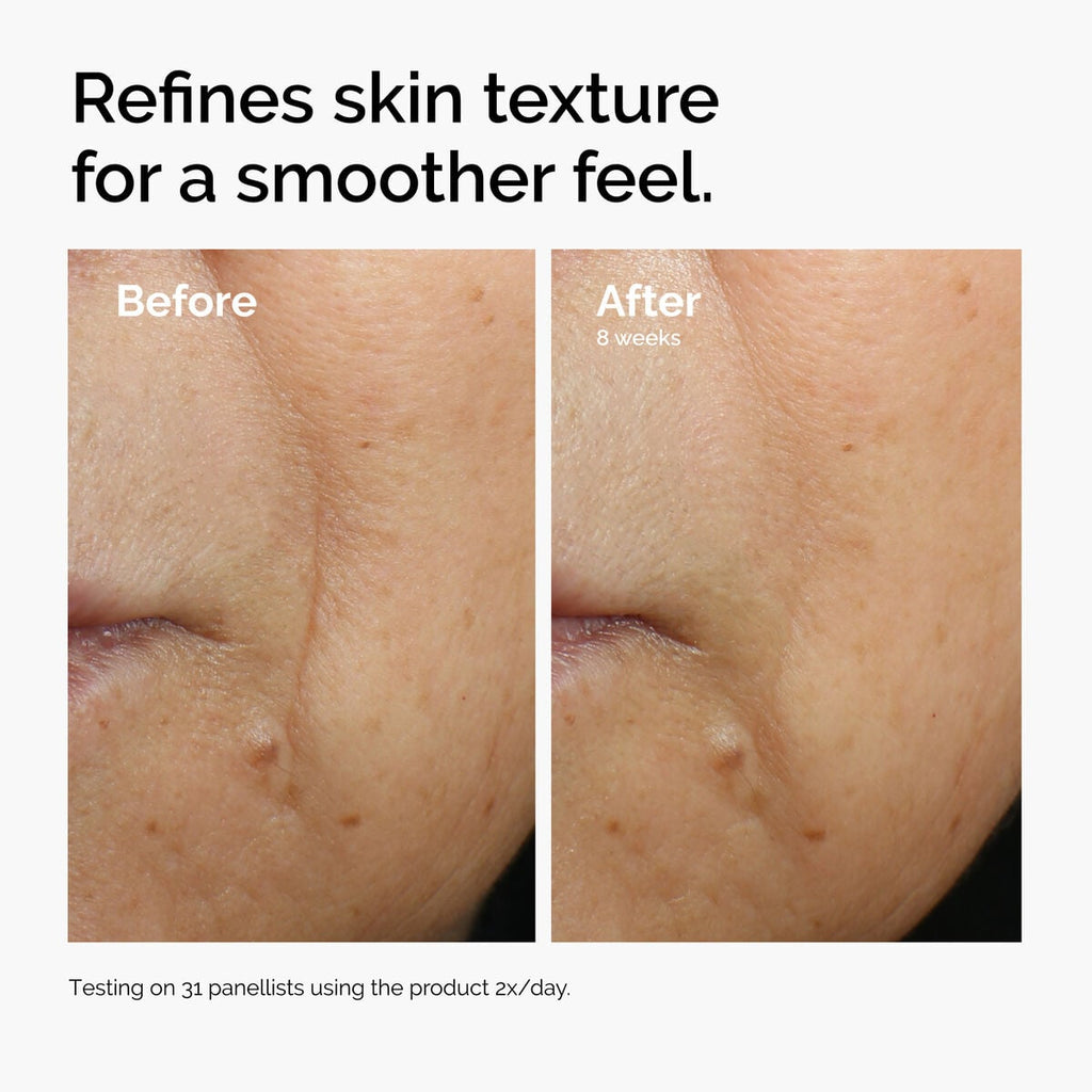 caffeine-3-escin-1-face-serum-x8 ord-caffeine-3pct-escin-1pct-face-serum-before-after-texture.jpg