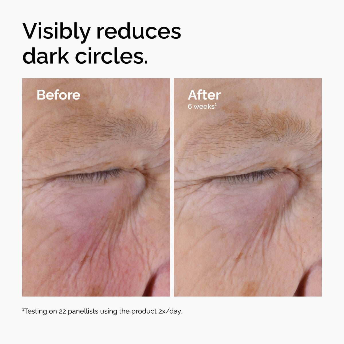 caffeine-solution-5-egcg-eye-serum-o4 ord-caffeine-solution-egcg-dark-circles-before-after.jpg