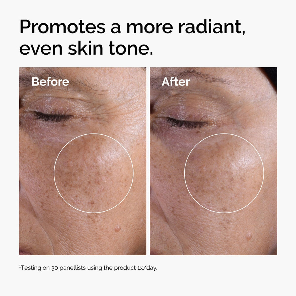 glycolic-acid-7-exfoliating-toner-j8 ord-glycolic-before-after-radiance.jpg