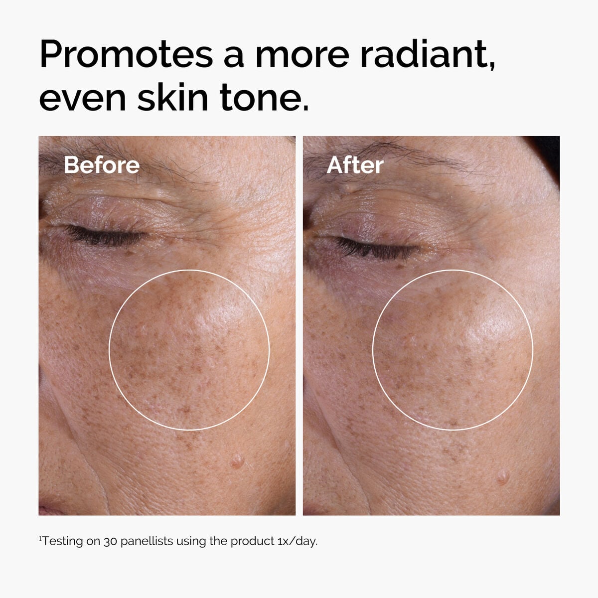glycolic-acid-7-exfoliating-toner-j8 ord-glycolic-before-after-radiance.jpg