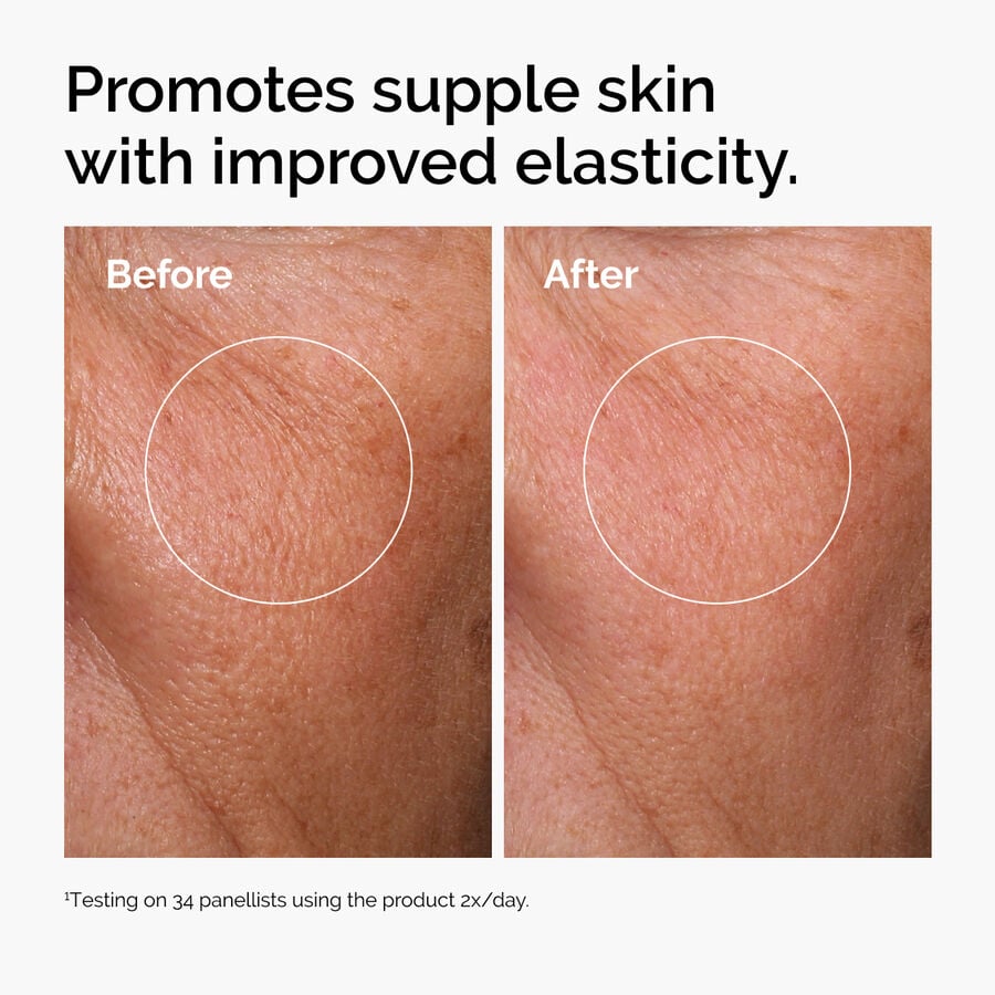 hyaluronic-acid-2-b5-with-ceramides-a5 ord-hyaluronic-acid-2pct-b5-hydrating-serum-before-after-elasticity.jpg