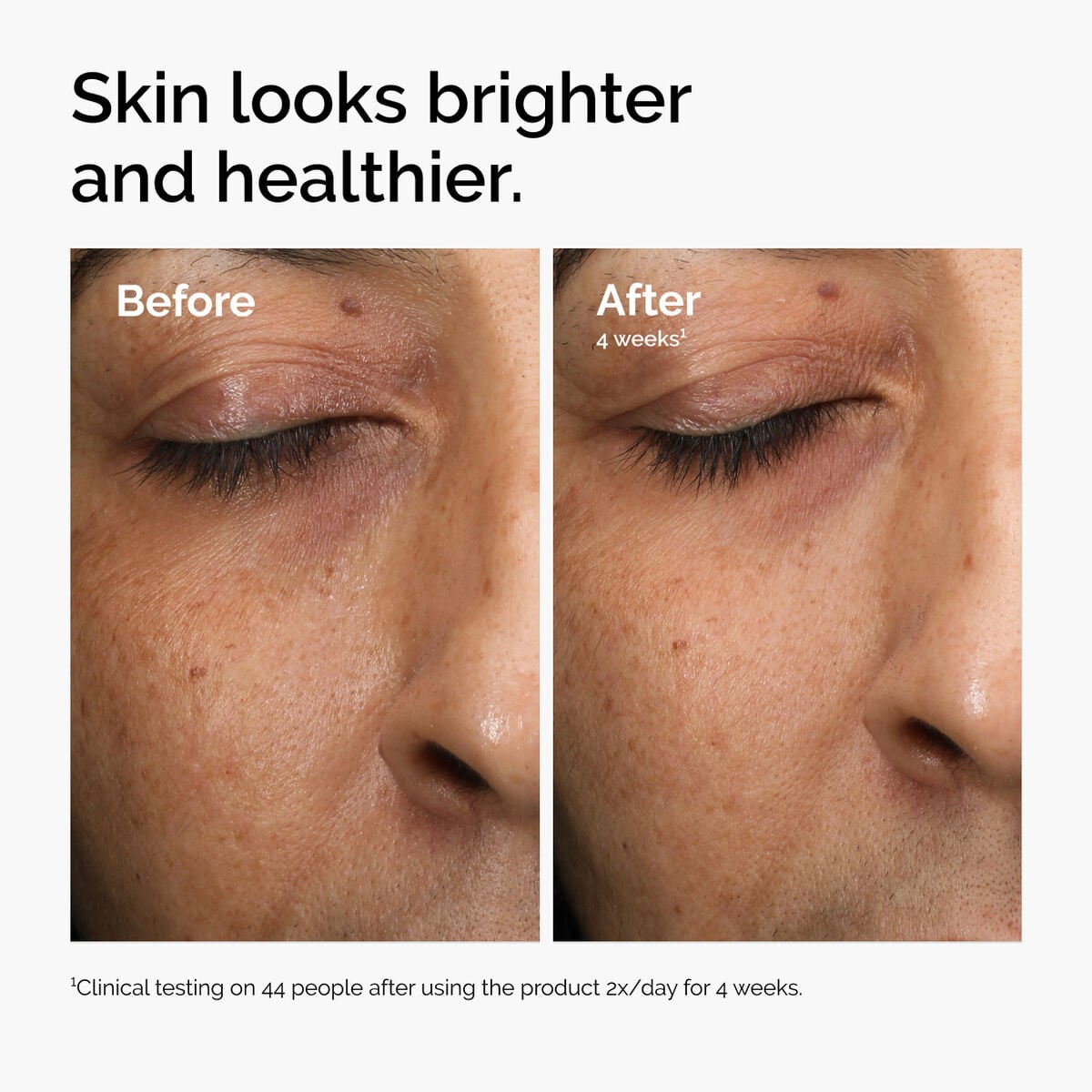 multi-antioxidant-radiance-serum-c3 ord-mars-before-after-healthy.jpg