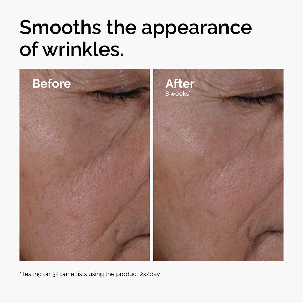 multi-peptide-ha-serum-q5 ord-multi-peptide-ha-serum-wrinkles-before-after.jpg