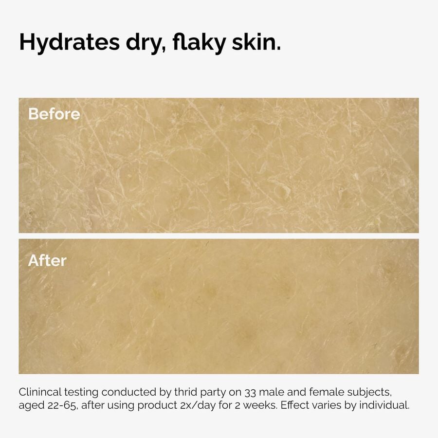 the-body-care-collection-h6 ord-natural-moisturizing-factors-inulin-body-before-after-graphic-02.jpg