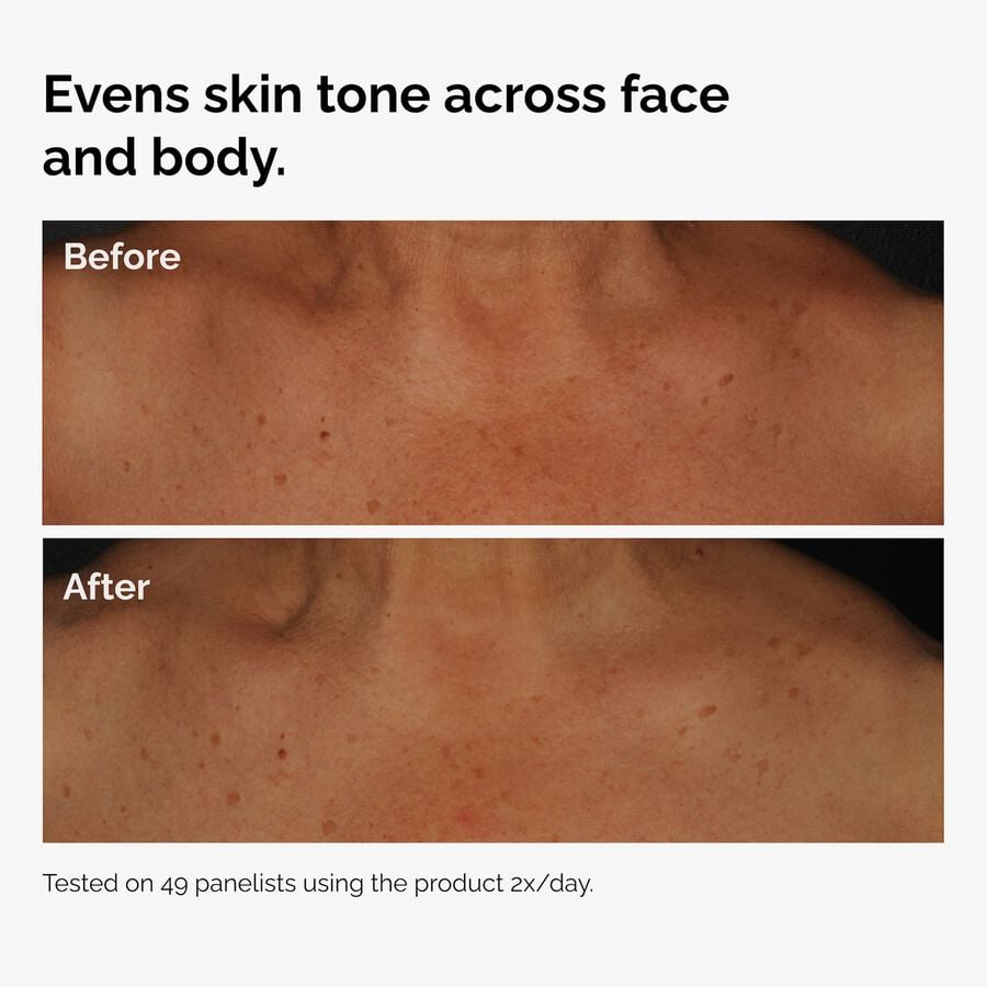 the-body-care-collection-h6 ord-niacinamide-face-body-serum-before-after-even-tone-graphic.jpg