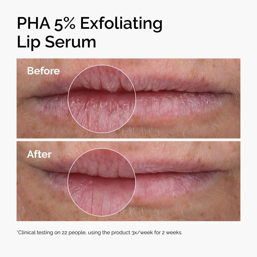 pha-5-exfoliating-lip-serum-j8 ord-pha-5pct-lip-exfoliating-serum-before-after.jpg