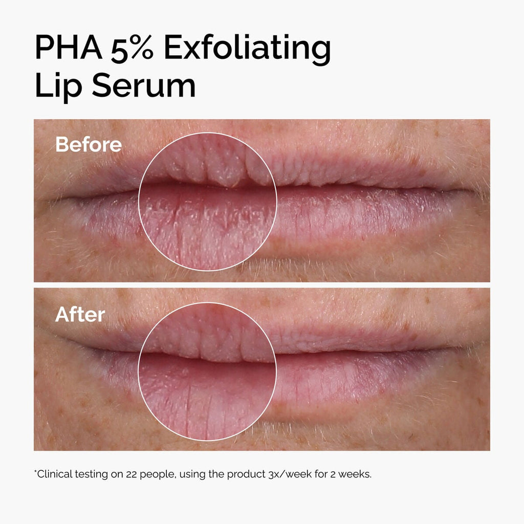 pha-5-exfoliating-lip-serum-j8 ord-pha-5pct-lip-exfoliating-serum-before-after.jpg