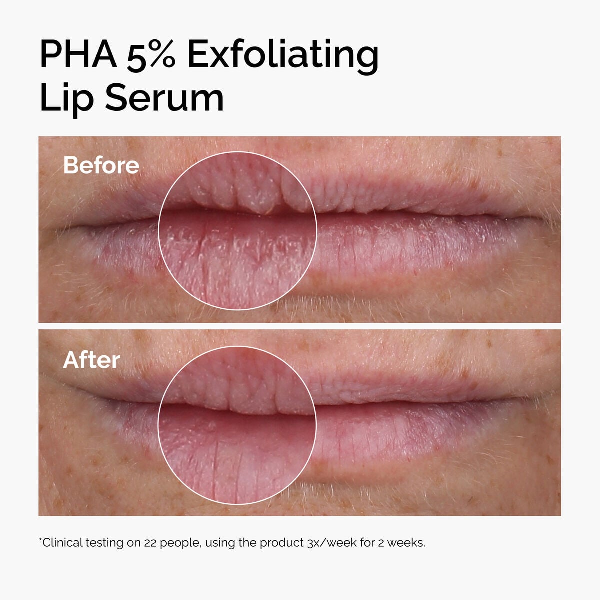 pha-5-exfoliating-lip-serum-j8 ord-pha-5pct-lip-exfoliating-serum-before-after.jpg