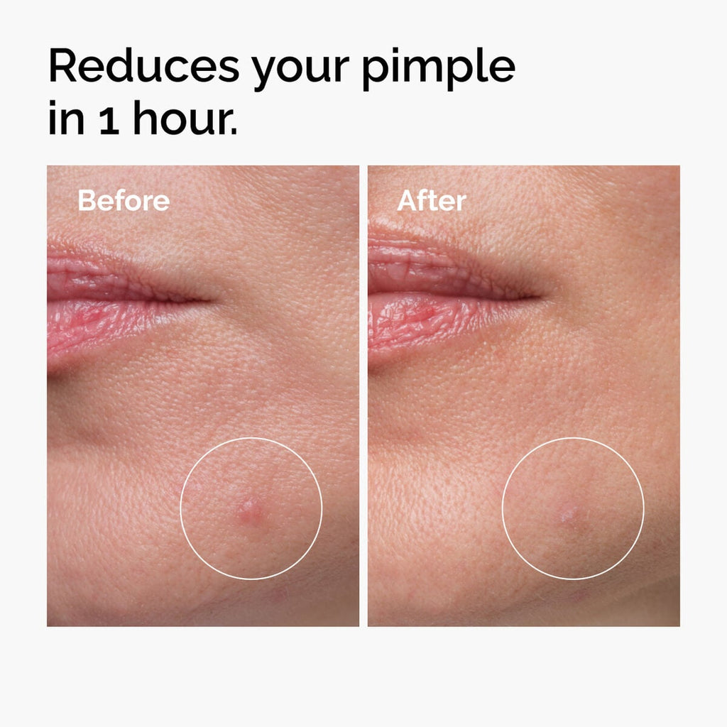 sulfur-10-powder-to-cream-concentrate-j9 ord-sulfur-10pct-powder-to-cream-concentrate-before-after-NA.jpg